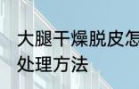 大腿干燥脱皮怎么办 大腿干燥脱皮的处理方法