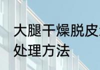 大腿干燥脱皮怎么办 大腿干燥脱皮的处理方法